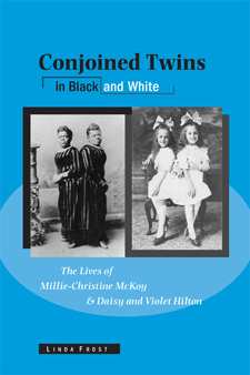 The cover of Frost's book is blue, with old photos of the two pairs of conjoined twins. One set of twins is white and one is black.